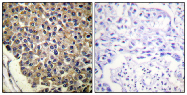 Phospho-CXCR2 (Ser347) Antibody in Immunohistochemistry (Paraffin) (IHC (P))