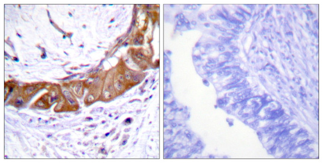 Phospho-IRAK1 (Thr100) Antibody in Immunohistochemistry (Paraffin) (IHC (P))