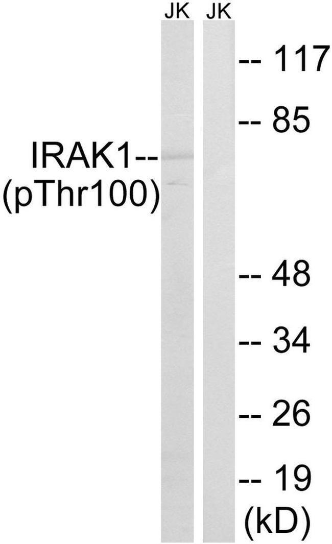 Phospho-IRAK1 (Thr100) Antibody in Western Blot (WB)