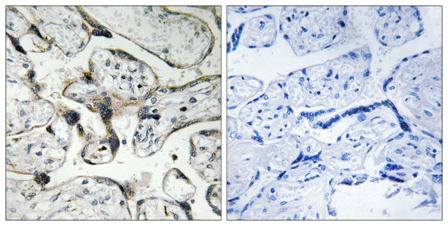 PAK1/PAK2 Antibody in Immunohistochemistry (Paraffin) (IHC (P))