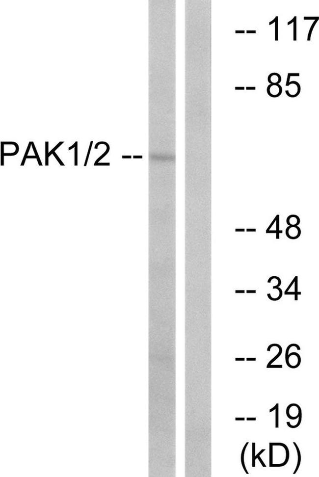 PAK1/PAK2 Antibody in Western Blot (WB)