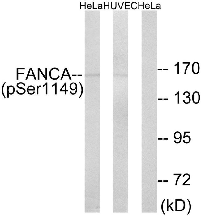 Phospho-FANCA (Ser1149) Antibody in Western Blot (WB)