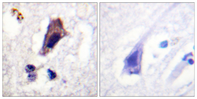 Phospho-PIKFYVE (Ser307) Antibody in Immunohistochemistry (Paraffin) (IHC (P))