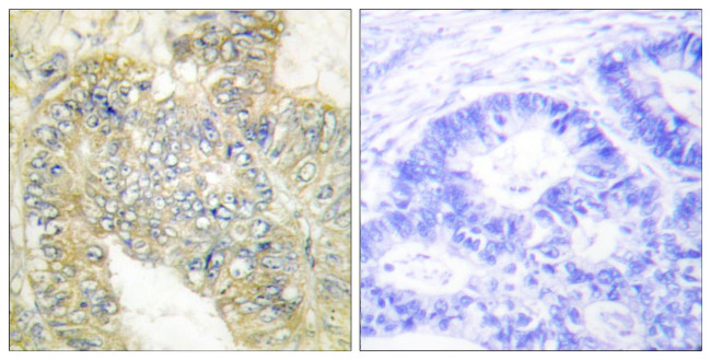 Phospho-Desmin (Ser60) Antibody in Immunohistochemistry (Paraffin) (IHC (P))