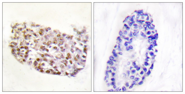 NFAT5 Antibody in Immunohistochemistry (Paraffin) (IHC (P))