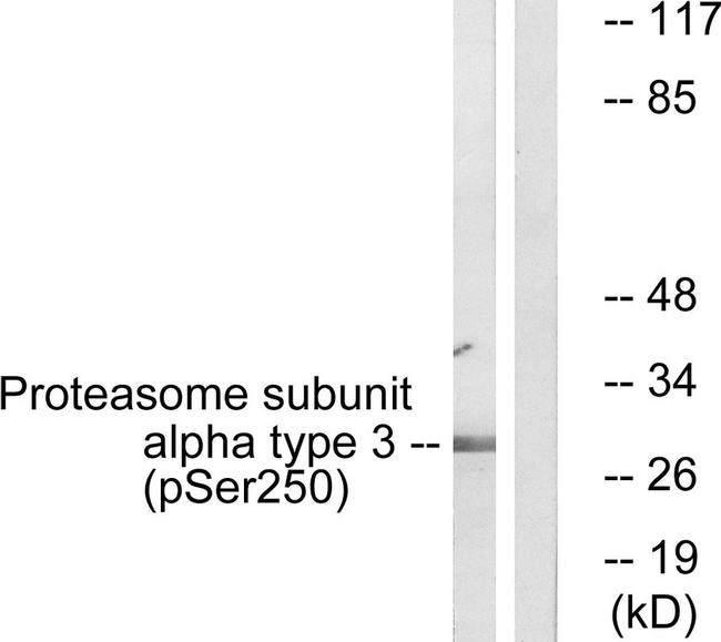 Phospho-PSMA3 (Ser250) Antibody in Western Blot (WB)