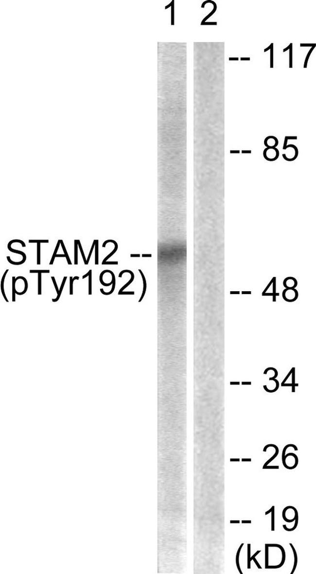 Phospho-STAM2 (Tyr192) Antibody in Western Blot (WB)