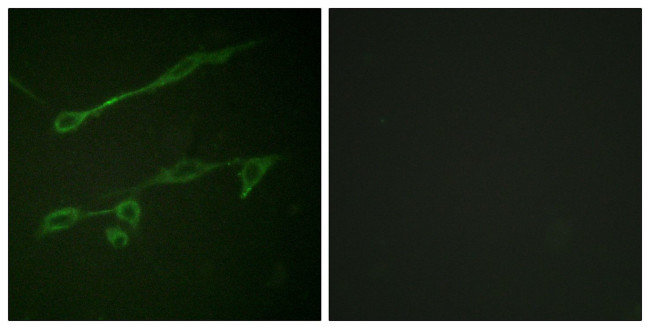 Phospho-VAV2 (Tyr142) Antibody in Immunocytochemistry (ICC/IF)