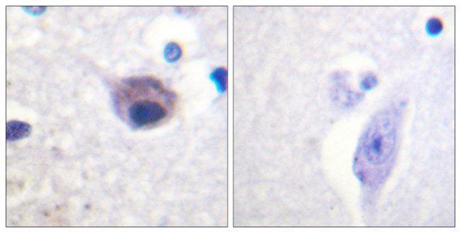 Phospho-VAV2 (Tyr142) Antibody in Immunohistochemistry (Paraffin) (IHC (P))