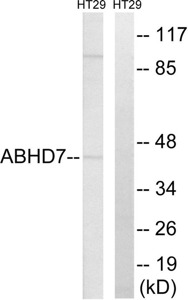 ABHD7 Antibody in Western Blot (WB)