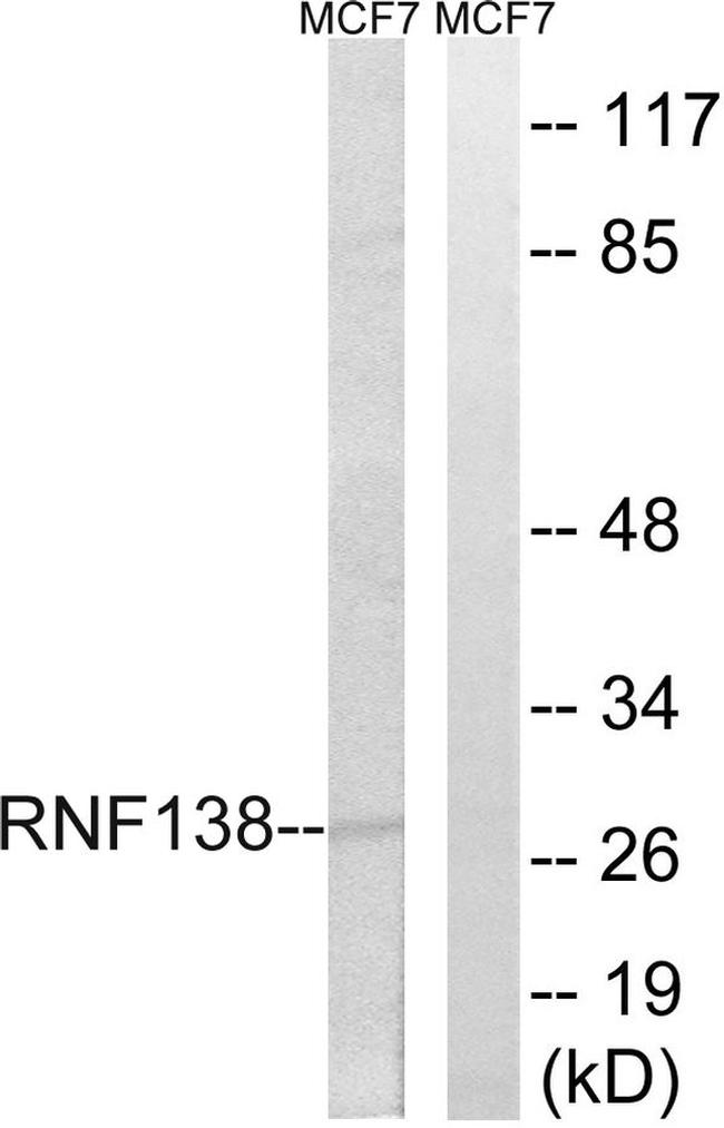 RNF138 Antibody in Western Blot (WB)