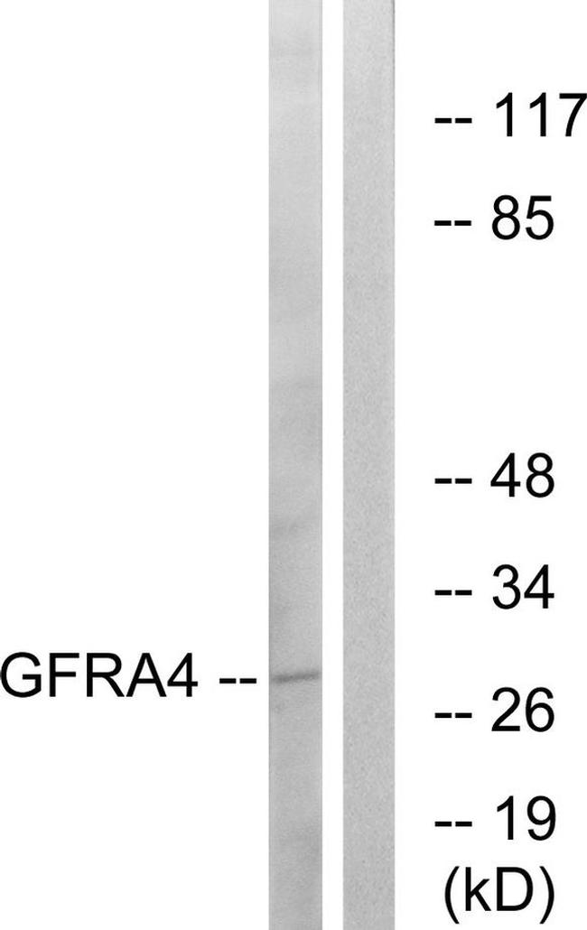 GFR alpha-4 Antibody in Western Blot (WB)