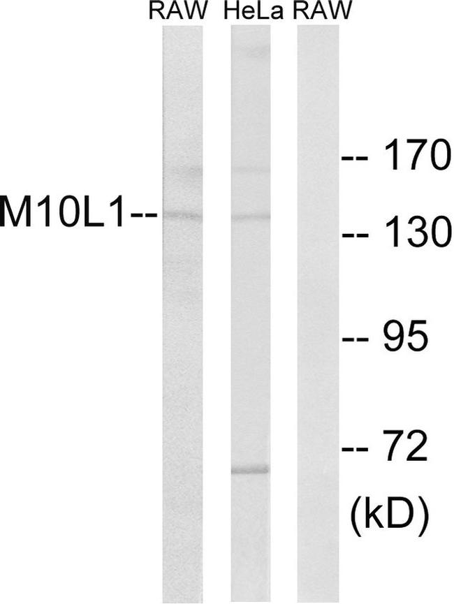 MOV10L1 Antibody in Western Blot (WB)