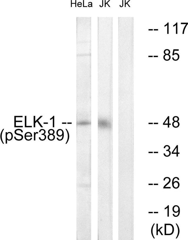 Phospho-ELK1 (Ser389) Antibody in Western Blot (WB)