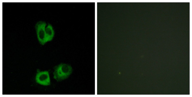 Phospho-LCK (Tyr394) Antibody in Immunocytochemistry (ICC/IF)