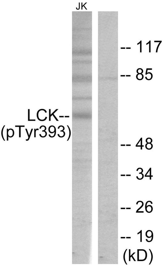 Phospho-LCK (Tyr394) Antibody in Western Blot (WB)