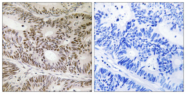 Phospho-STAT2 (Tyr631) Antibody in Immunohistochemistry (Paraffin) (IHC (P))