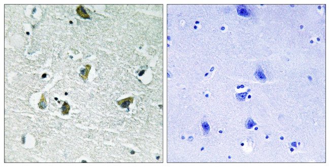 Phospho-JAK2 (Tyr931) Antibody in Immunohistochemistry (Paraffin) (IHC (P))