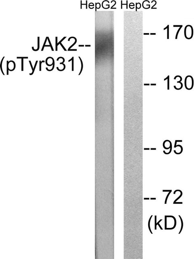 Phospho-JAK2 (Tyr931) Antibody in Western Blot (WB)