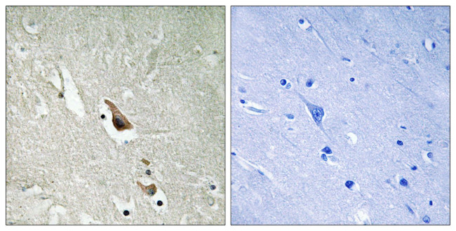 Phospho-TAK1 (Ser439) Antibody in Immunohistochemistry (Paraffin) (IHC (P))