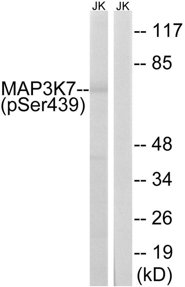 Phospho-TAK1 (Ser439) Antibody in Western Blot (WB)