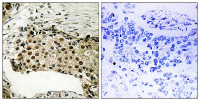 Phospho-MSK1 (Ser212) Antibody in Immunohistochemistry (Paraffin) (IHC (P))