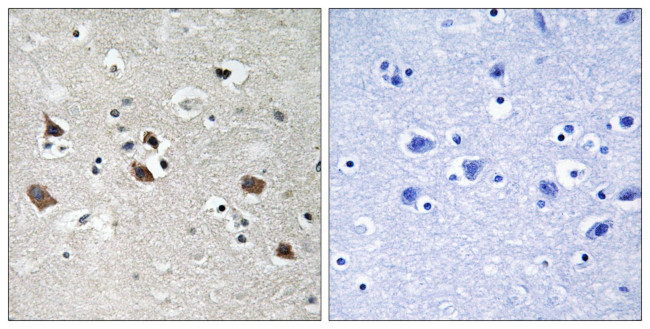 Phospho-SLP76 (Tyr128) Antibody in Immunohistochemistry (Paraffin) (IHC (P))