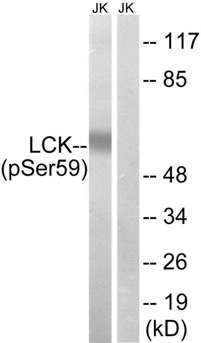 Phospho-LCK (Ser59) Antibody in Western Blot (WB)