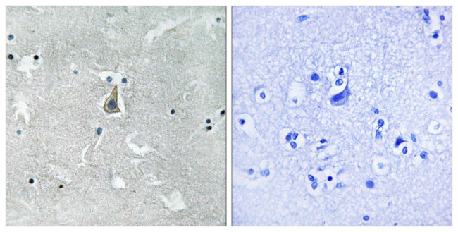 Phospho-Bax (Ser184) Antibody in Immunohistochemistry (Paraffin) (IHC (P))