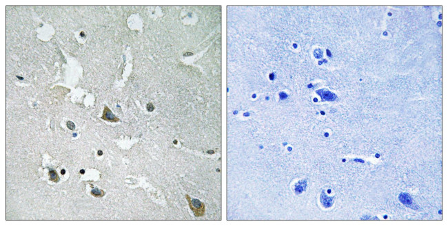 Phospho-TIRAP (Tyr86) Antibody in Immunohistochemistry (Paraffin) (IHC (P))