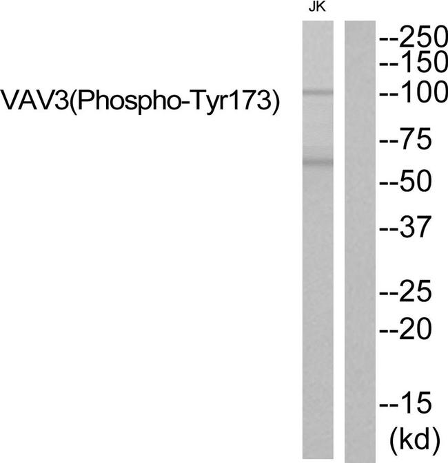 Phospho-VAV3 (Tyr173) Antibody in Western Blot (WB)