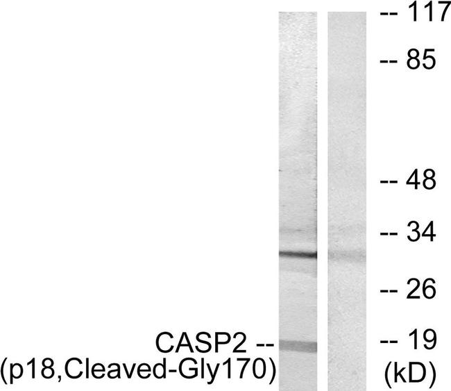 Caspase 2 p18 (Cleaved Gly170) Antibody in Western Blot (WB)