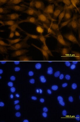 OTX2 Antibody in Immunocytochemistry (ICC/IF)