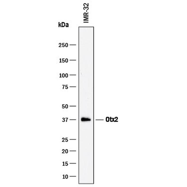 OTX2 Antibody in Western Blot (WB)