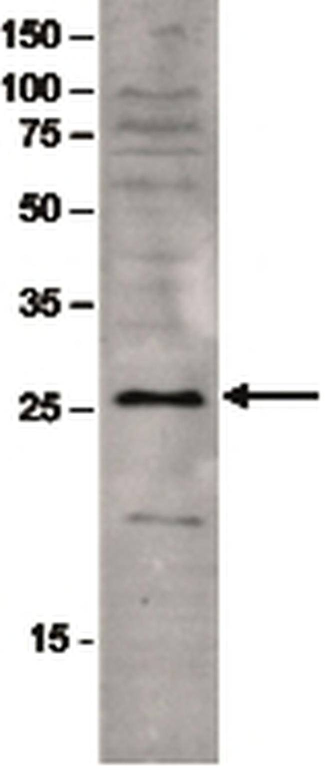 SAP30 Antibody in Western Blot (WB)