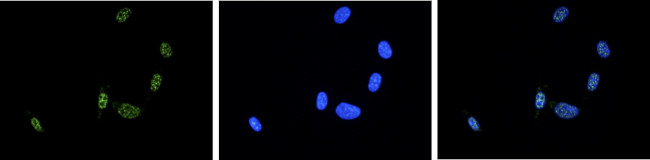 ASH2L Antibody in Immunocytochemistry (ICC/IF)