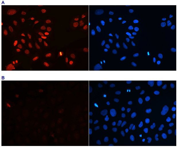 H4K20me3 Antibody in Immunocytochemistry (ICC/IF)