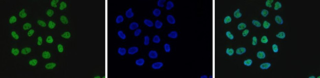 H4K8ac Antibody in Immunocytochemistry (ICC/IF)