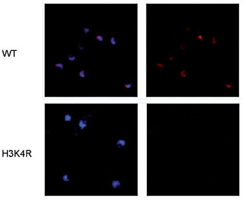 H3K4ac Antibody in Immunocytochemistry (ICC/IF)