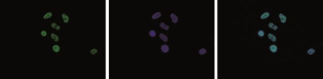 H2A.Zac pan-acetyl (K4,K7,K11) Antibody in Immunocytochemistry (ICC/IF)