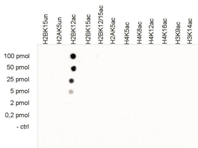 H2BK12ac Antibody