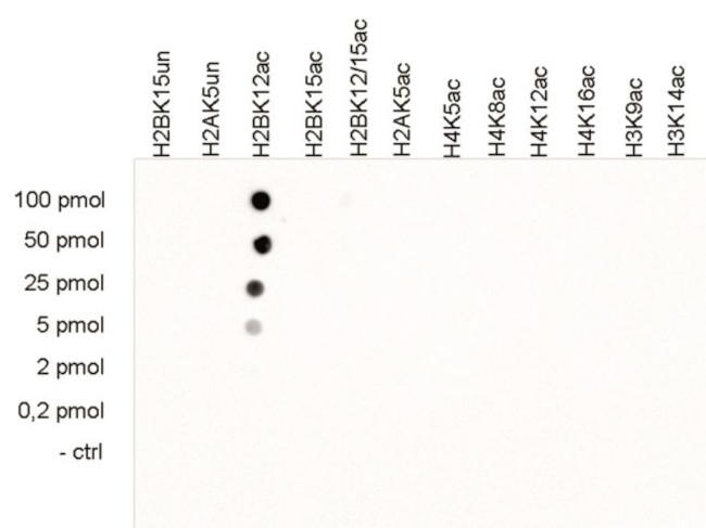 H2BK12ac Antibody in Peptide array (ARRAY)