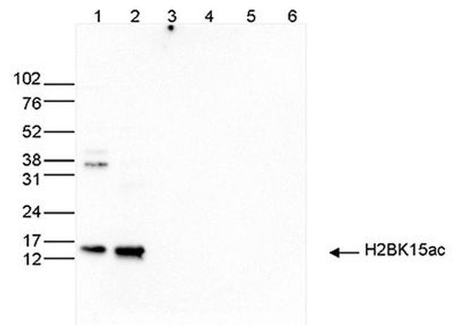 H2BK15ac Antibody in Western Blot (WB)