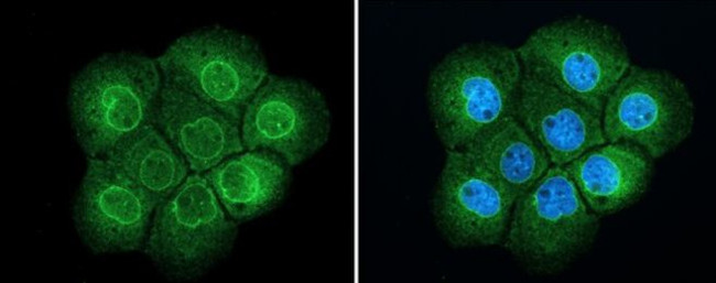 TPR Antibody in Immunocytochemistry (ICC/IF)