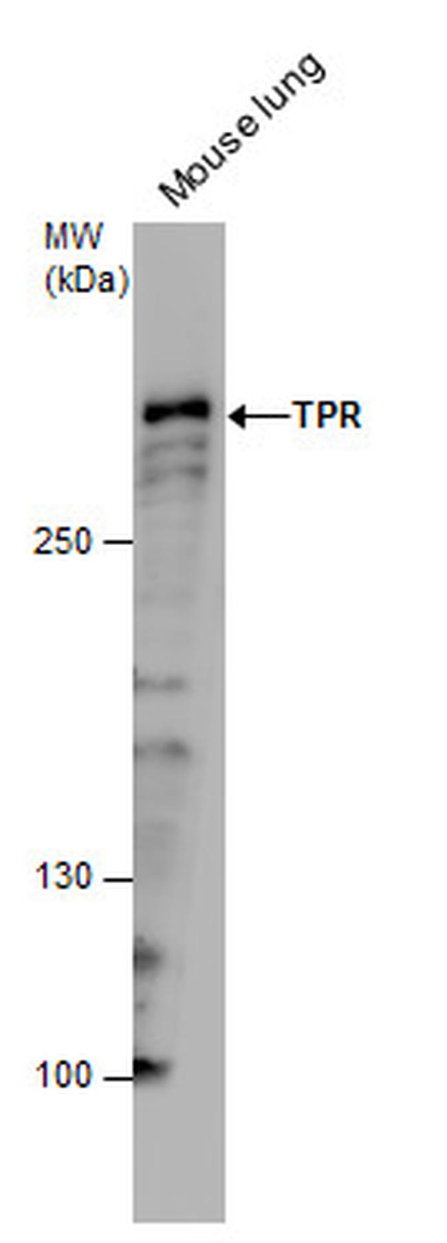 TPR Antibody in Western Blot (WB)