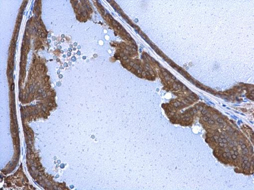 STX17 Antibody in Immunohistochemistry (Paraffin) (IHC (P))