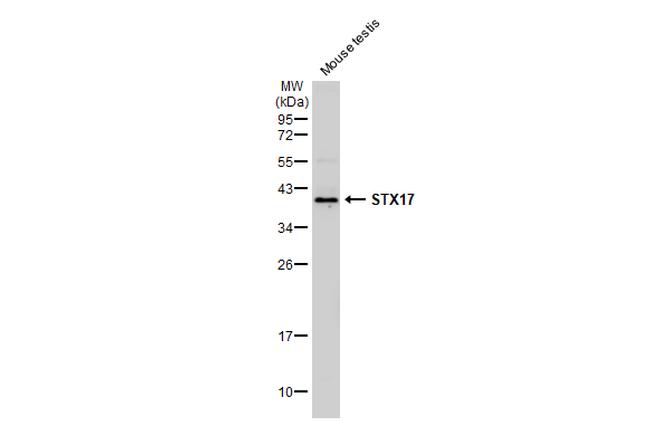 STX17 Antibody in Western Blot (WB)