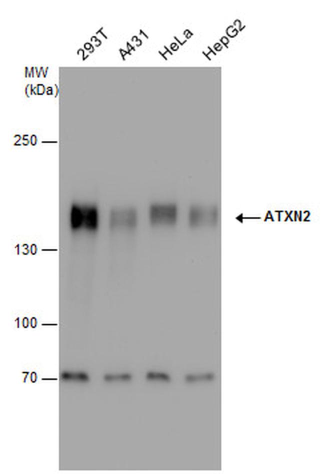 Ataxin 2 Antibody in Western Blot (WB)