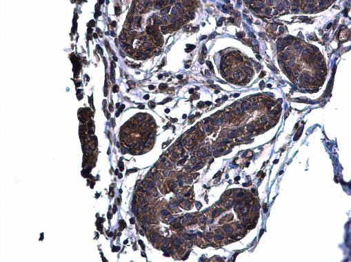 Glutaminase C (GAC) Antibody in Immunohistochemistry (Paraffin) (IHC (P))