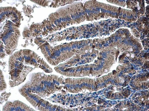 Glutaminase C (GAC) Antibody in Immunohistochemistry (Paraffin) (IHC (P))